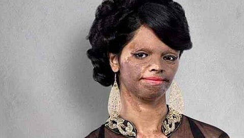 Acid Attack Surviver : दोन पलंग, दोन कपाट….हवे- लक्ष्मी अग्रवालचे ट्विट ट्रेंडिंगमध्ये