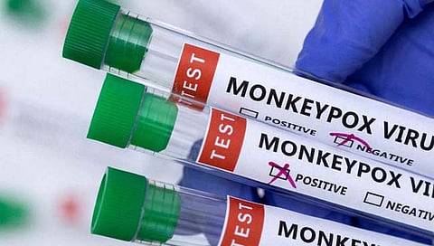 ‘मंकीपॉक्स’ वर नजर ठेवण्यासाठी केंद्राकडून टास्क फोर्सची स्थापना