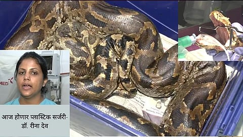 Indian Rock Python : जखमी अजगराला वाचवण्यासाठी डॉक्टर आणि वन्य प्रेमींचे शर्थीचे प्रयत्न