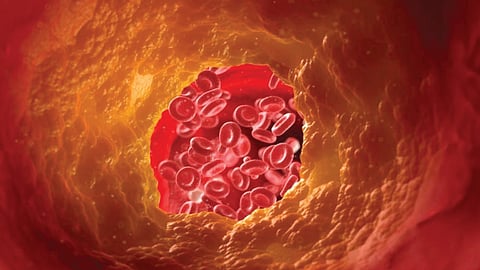 कोलेस्ट्रॉलच्या नियंत्रणासाठी ‘हा’ पदार्थ अत्यंत उपयोगी