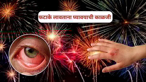 Diwali Safety Tips : दिवाळीत फटाके लावतायं? तर अशी घ्या काळजी