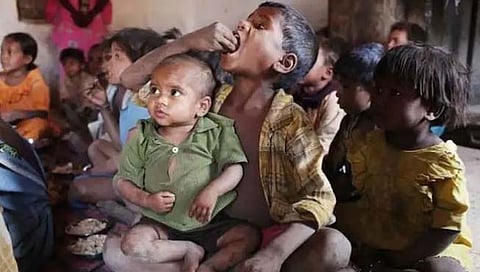 World Hunger Index 2022: नामुष्कीचे वास्तव..! जागतिक भूक निर्देशांकात भारत पाकिस्तान नेपाळच्याही मागे