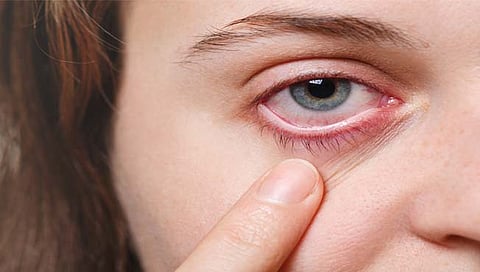 डोळ्यातील ओलावा कमी झाल्यास…