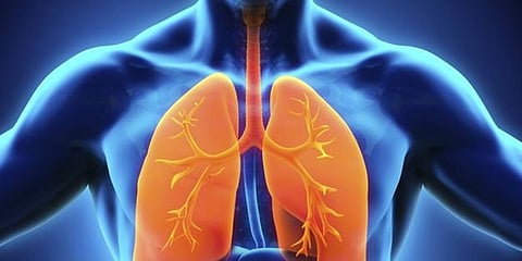 स्वाइन फ्लू