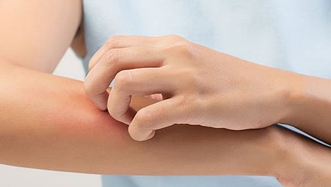 बुरशी संसर्गापासून राहा सावध; ‘डब्ल्यूएचओ’ने जाहीर केली 19 संसर्गांची यादी