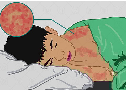 पिंपरी : शहरात नक्की रुग्ण किती ? खासगी रुग्णालयातील रुग्णाची नोंदच नाही