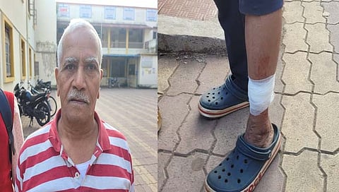 मगरीचा व्यक्तीवर हल्ला