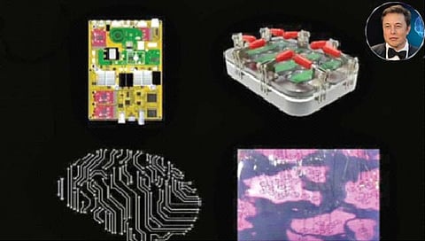 Neuralink : केवळ विचाराने कॉम्प्युटर चालेल अन् अंध व्यक्तीही पाहू शकेल : एलन मस्क
