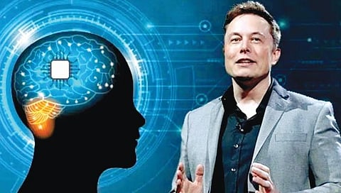 संशोधन : मेंदूत चीप?