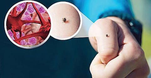 पुणे : डुकराच्या रक्तनमुन्यात जेईचा विषाणू नाही; विविध भागांत ताप रुग्ण सर्वेक्षण अधिक गतिमान