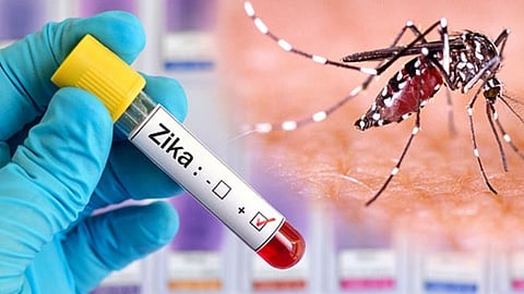 Zika Virus