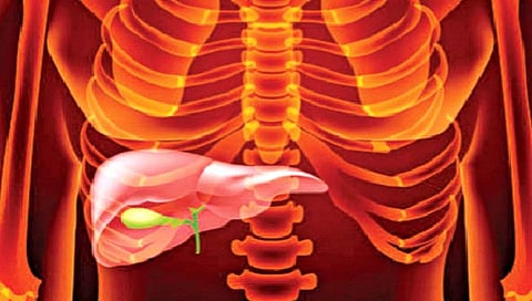 Gall bladder : पित्ताशयात खडे का होतात?