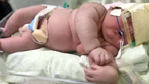 supersize baby : वजनदार बाळाचा जन्म; तब्बल ७ किलो वजन आणि २ फूट लांबीचे बाळ पाहून डॉक्टरही चक्रावले