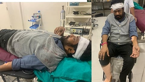 Bacchu Kadu Accident News : आमदार बच्चू कडू यांना भरधाव दुचाकीने उडवले; डोक्याला आणि पायाला गंभीर दुखापत