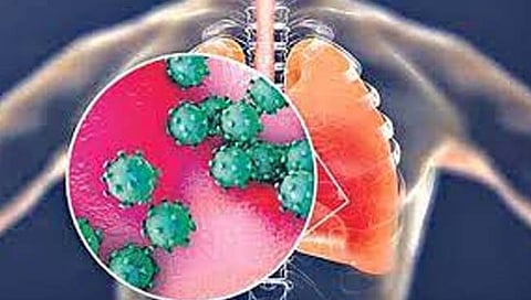 ठाण्यात इन्फ्लूएंझाचे सहा रुग्ण सापडले