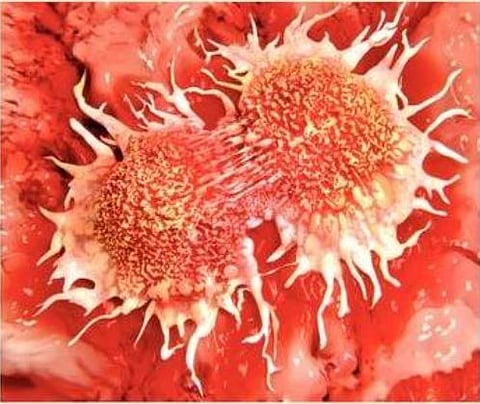 कर्करोगाच्या पेशी शोधणारे यंत्र विकसित