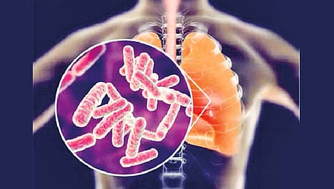 मुंबईवर क्षयरोगाचे संकट; कस्तुरबा रुग्णालयात होणार जिनोम सिक्वेन्सिंग चाचणी
