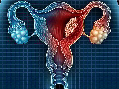 गर्भाशयाच्या कर्करोगाच्या प्रमाणात दुप्पट वाढ
