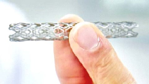 हृदयरोगावरील ‘स्टेन्टस्’च्या किमतीवर नियंत्रण