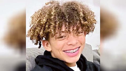 ‘मशाल’ बनण्याच्या प्रयत्नात भाजला रिल्स स्टार!