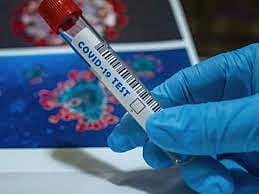 नागरिकांनो काळजी घ्या: कोरोनाबाधितांचा दुपटीचा वेग 10 दिवसांवर, आरोग्य यंत्रणा झाली सतर्क