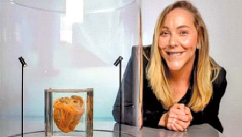 ‘तिने’ संग्रहालयात पाहिले स्वतःचेच काढलेले हृदय