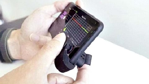 रक्तदाब मोजणारी अवघ्या पाच रुपयांची क्लिप