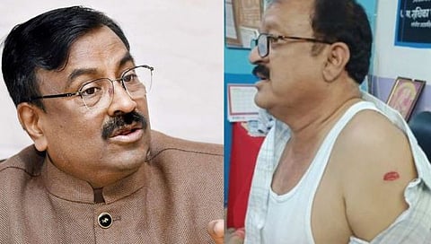 रावत यांच्यावर हल्ला करणाऱ्यांना तात्काळ अटक करा; पालकमंत्री मुनगंटीवारांचे निर्देश