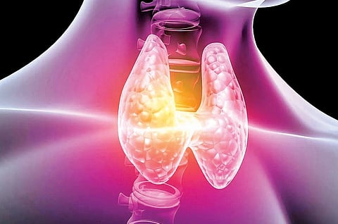 पुणे : अतिरिक्त थायरॉईडचा हाडांवर विपरीत परिणाम