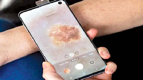 त्वचेचा कर्करोग