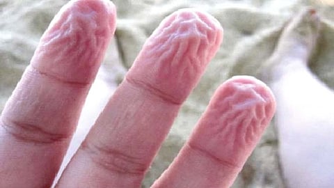 पाण्यात बराच वेळ राहिल्याने बोटांना का पडतात सुरकुत्या?