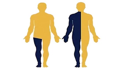 Paralysis : पस्तीशीत गाठतोय पक्षाघात; वेळीच सावध होणे गरजेचे