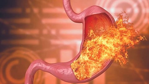 peptic ulcer : धोका पेप्टिक अल्सरचा