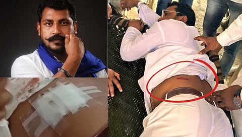 Bhim Army Chief Chandrashekhar Azad : भीम आर्मी चिफ चंद्रशेखर आझाद यांच्यावर जीवघेणा हल्ला