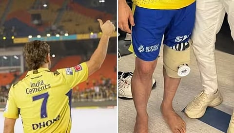 MS Dhoni Knee Surgery : धोनीच्या गुडघ्यावर यशस्वी शस्त्रक्रिया! IPLच्या पुढच्या हंगामात धमाका करण्यास सज्ज