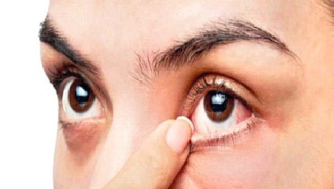 द़ृष्टिदोष टाळण्यासाठी…