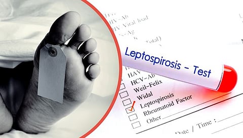 मुंबईत लेप्टोचा पहिला बळी! नायर हॉस्पिटलमधील १४ जून रोजी मृत पावलेल्या रुग्णाचा अहवाल | First Death of Lepto