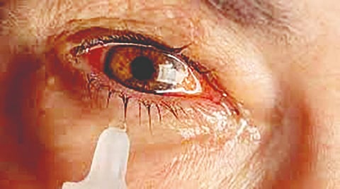 कोल्हापूर : सावधान! जिल्ह्यात डोळे येण्याची साथ फैलावतेय