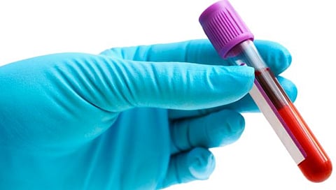 सांगली : बाप रे… सॅम्पल एकच..लॅब चार, रिपोर्ट चार वेगवेगळे !