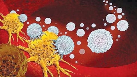 हाडांच्या दुर्मीळ कर्करोगावर इम्युनोथेरपी वरदान