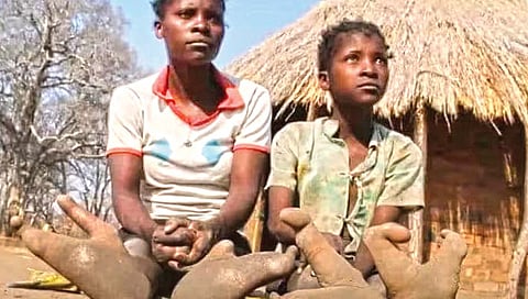 ‘त्यांचे’ पाय शहामृगासारखे!