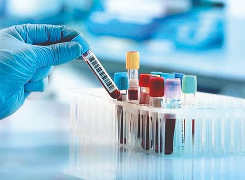 सरकारी रुग्णालयांत केसपेपर, विविध चाचण्या होणार नि:शुल्क