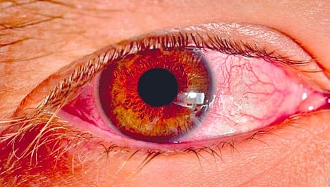 Eye Care Tips : पावसाळ्यात अशी घ्या डोळ्यांची काळजी…