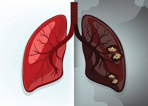 पुणे : निरोगी फुफ्फुसांसाठी ’डिटॉक्स’ आवश्यक