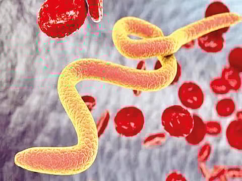 Treatment of stomach worms : पोटातील जंतावर हे आहेत सोपे घरगुती उपचार