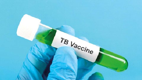 क्षयरोगावरील प्रभावी लस लवकरच