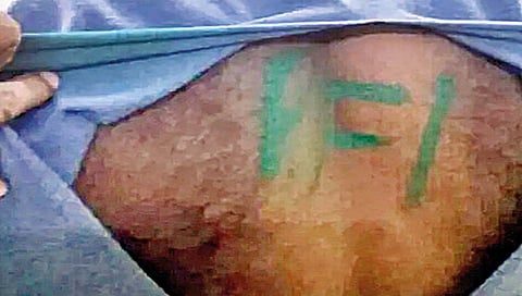 लष्कराच्या जवानावर हल्ला; पाठीवर लिहिले ‘पीएफआय’