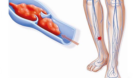 Swollen Feet causes | पायांना सूज कशामुळे येते?, जाणून घ्या कारणे आणि उपाय