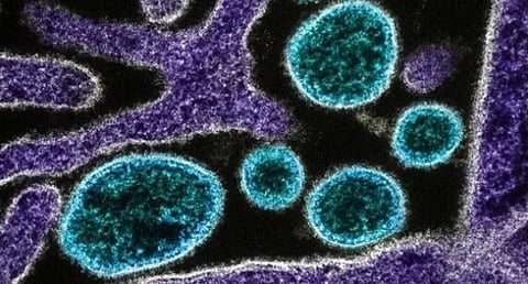 प्रातिनिधिक छायाचित्र.