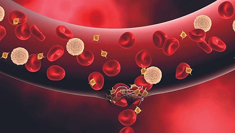 हिमोफिलियाचा मुकाबला कसा कराल? जाणून घ्या सविस्तर